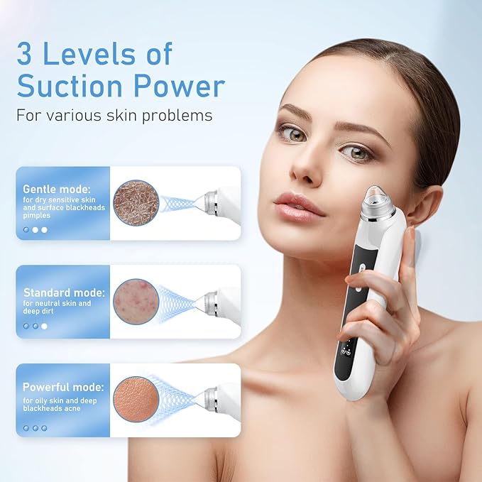 Blackhead Remover Vacuum, USB Interface Type Pore Vacuum, Black Head Extractions Tool with Camera for Men and Women Pore Cleaner, 3 Adjustment Modes & 6 Suction Heads(Black)