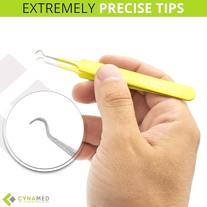 Blackhead Tweezer - Professional Curved Steel Tip Surgical Comedone & Splinter Extractor. Ideal Blemish & Acne Remover Tool Means Flawless Facial Skin (Yellow)