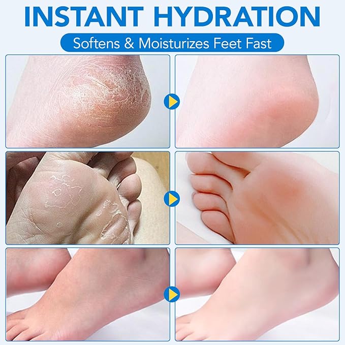 2Pack Urea Cream 60% plus Salicylic Acid 2% Urea Foot Care Stick,Foot Cream for Foot Callus Remover, Feet Moisturizer Stick for Dry Cracked Heels, Hands, Knees,Hydrating Heel Balm, Easy To Use