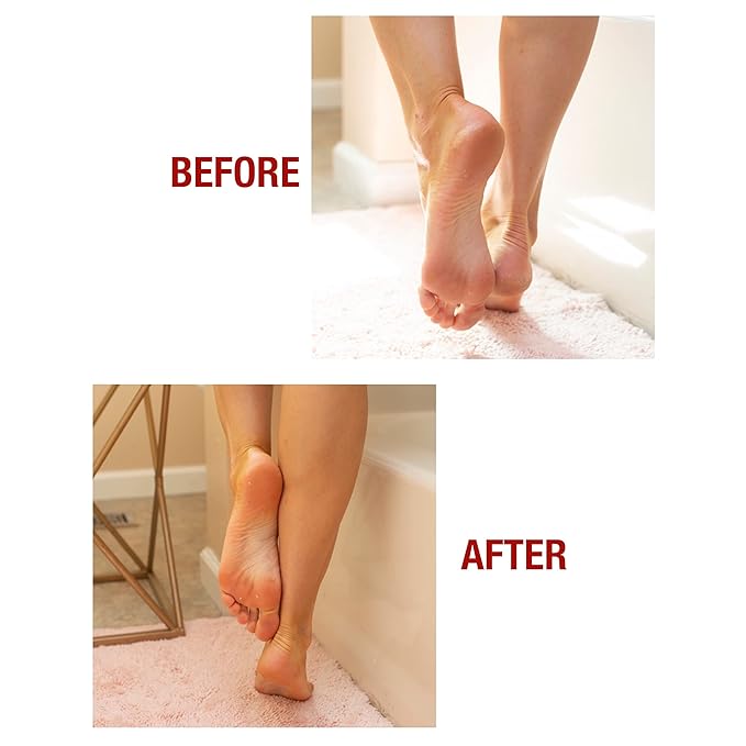 Kerasal Intensive Foot Repair Skin Healing Ointment,1 Oz and Moisturizing Gel Socks,(Packaging May Vary),(Pack of 4)