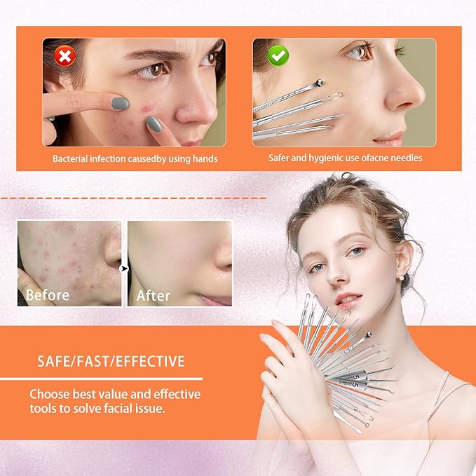 2026 Professional Pimple Popper Tool Kit, 20 PCS Blackhead Remover Tools，Blackhead Remover Comedone Extractor Tools for Removing Zit on Face - Acne Removal Kit with Metal Case (Silver)
