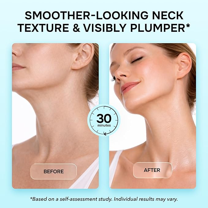 V Line Lifting Mask with Collagen, Retinol & Hyaluronic Acid - Caffeine, Niacinamide Visible Neck Tightening and Chin Lifting Mask for Women - Double Chin Strap for Face & Jawline Shaper - 7 pcs