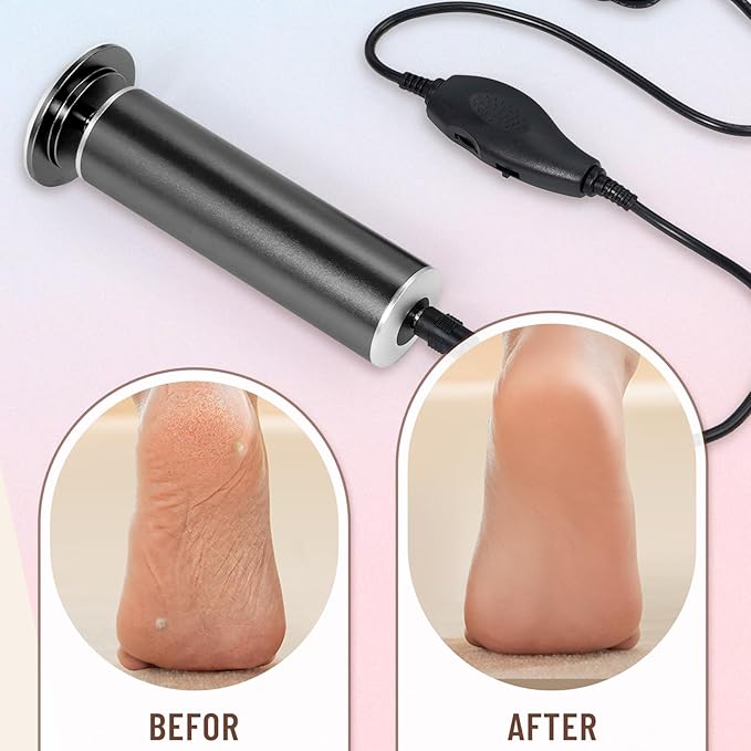 Dermawave Electric Foot File Callus Remover for Feet, Professional Electric Foot Sander Filer Grinder with 60 Sandpaper Discs for Men & Women, Pedicure Tool for Corn Dead Skin Cracked Heel