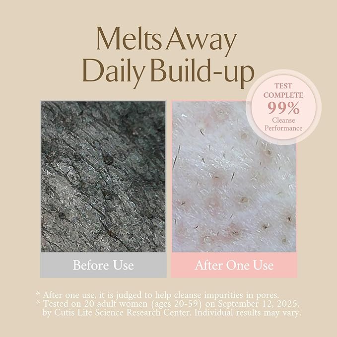 LA MUSE Melting Grinding Cleansing Balm 6.76 fl oz | Hydrating Facial Wash | Exfolaiation Management | Makeup Remover Balm | Moisturizing Pore Cleanser | Soft Melt | Elastic Care | Korean Skin Care