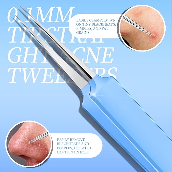 Teenitor 7 Pcs Professional Blackhead Remover Tweezers and Pimple Popper Tool Kit, Tweezers for Women Facial Hair, Blackhead Extractor, Pimple Extractor, Light Blue