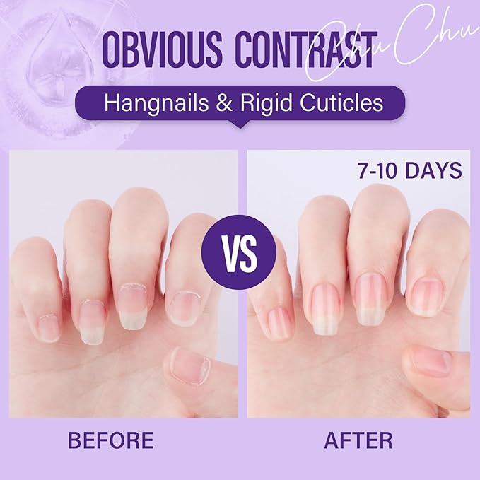 CHUCHU Cuticle Oil for Nails: Lavender Jojoba Nail Cuticle Oil with Vitamin B & E for Moisturizes Cuticle and Nail's Skin - Prevents Hangnails and Chapped 15ML
