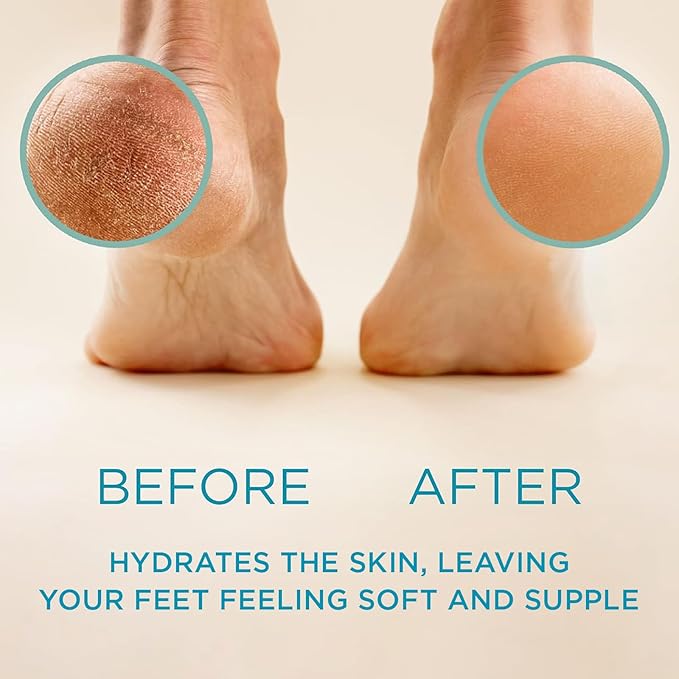 Lee Beauty 8oz Professional Gel Callus Remover for Feet - Original Fast-Acting Formula and Rasp Foot File Kit, Extra Strength for Cracked Heels & Dead Skin (Pack of 1)