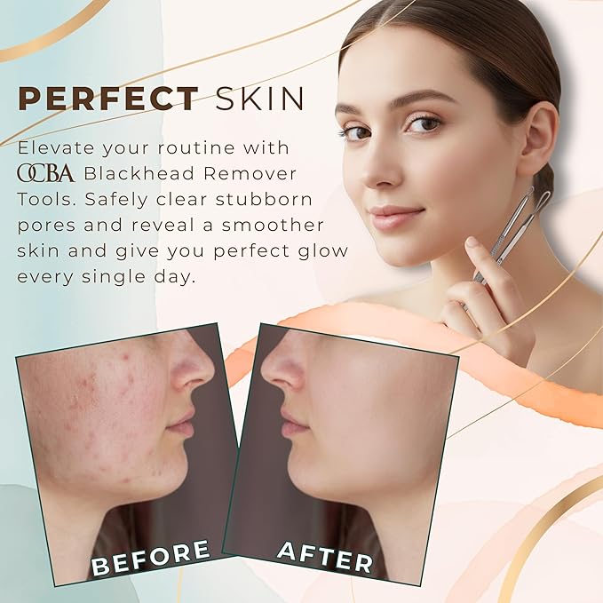 Blackhead Remover Professional Skincare Spot Treatment Blackhead Remover Tool for Blemish Comedone Whiteheads Pimple Popper with Double Sided Soft Touch and Anti-Slip Design (Silver 2Pcs)