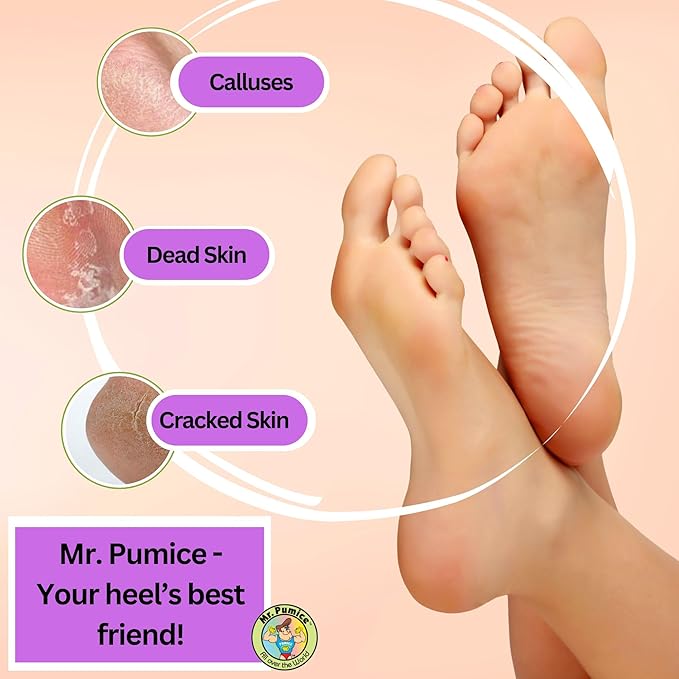 Mr. Pumice Purple PUMI Bar - Extra-Coarse, Pumice Stone for Feet Callus Remover, Pedicure Tools for Feet, Foot Scrubber for Dead Skin Remover, Foot Care, 4 Pack