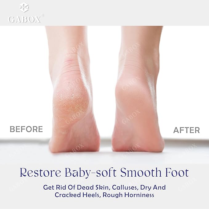 GABOX Nano Glass Pro Foot File - Callus Remover for Feet - Heel Foot Scrubber Dead Skin Exfoliator - Pedicure SPA Tool for Women & Men - Removedor de Callos en Los Pies - Crystal Blue