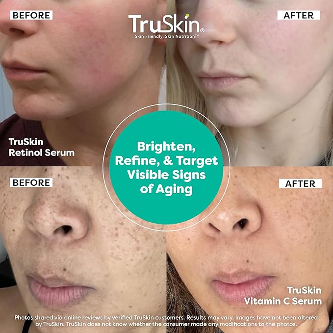 TruSkin Face Serum Duo – Vitamin C Serum & Retinol Serum for Face – AM & PM Anti Aging Skincare Routine – Brightening & Smoothing Facial Serums, 1 fl oz Each