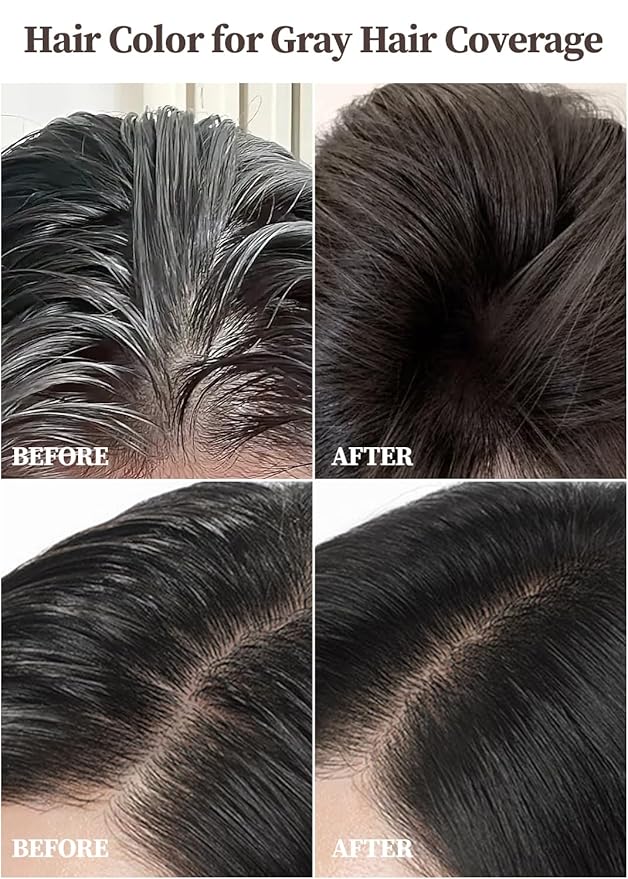 Hair Dye + Ampoule Treatment, Permanent Hair Color, 100% Gray Coverage, Hair Loss Care, 2-Step Shampoo– 5-Minute Hair Color for Women & Men & Scalp Care Formula, Repair & Restore (Dark Brown)