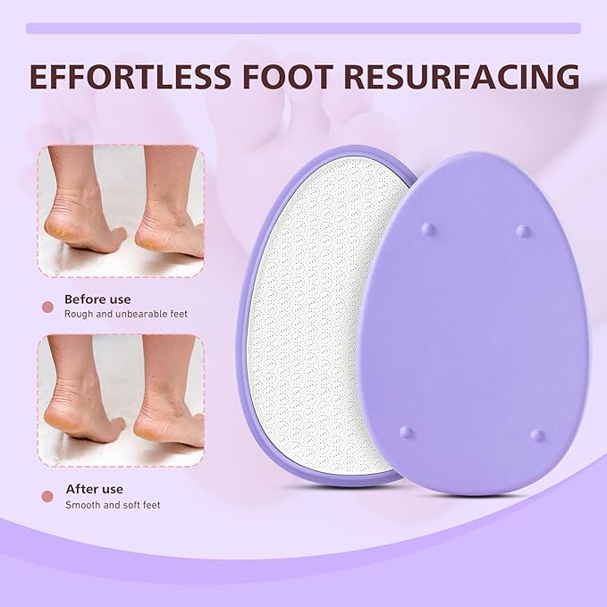 BALUCA Glass Foot File Callus Remover for Feet - Nano Glass Foot Scraper Scrubber Dead Skin Removal for Cracked Heels,Professional Pedicure Tool for Home, Salon, and Travel (Purple)