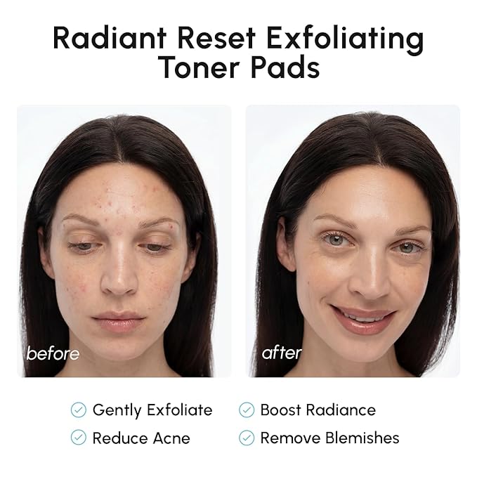 MAREE Glycolic Acid Resurfacing Pads - Toner Pads for Face Cleansing - Exfoliating Pad with Tea Tree Oil, Salicylic Acid & Vitamins E, B3, B5 - Acne Treatment Device for Pore Resurfacing - 50 Count