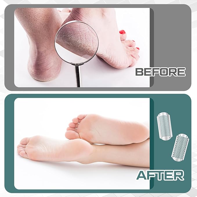 Moxweyeni 7 Pack Colossal Foot File Pedicure Tools Sets with 2 Styles Large and Small Hole Replacement Callus Remover Blades, Stainless Steel Detachable Pedicure Foot Rasp for Dead Skin Remover