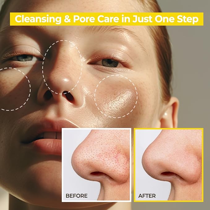 AVCA Blackhead Remover Cleansing Oil 10.14 fl oz (300 ml) – Makeup & Sebum-Dissolving Cleanser, PHA Gentle Exfoliator, Lightweight Pore Care, Korean Skincare for Normal & Oily Skin
