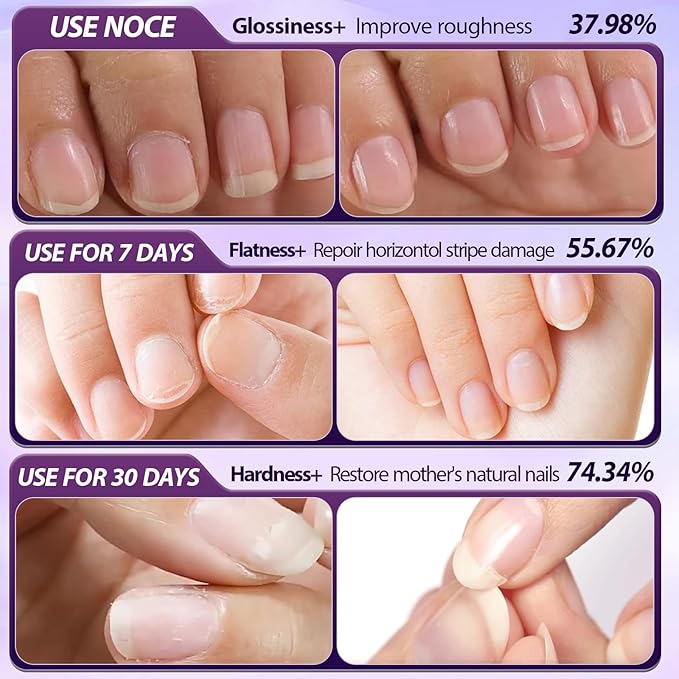 3-in-1 Cuticle Oil Pen,Cuticle Pusher Nail Oil Pen with Ceramic Tip,Dry & Damaged Nails,Nail Cuticle Remover Pen,for Moisturize Strengthen Nails(2PCS)