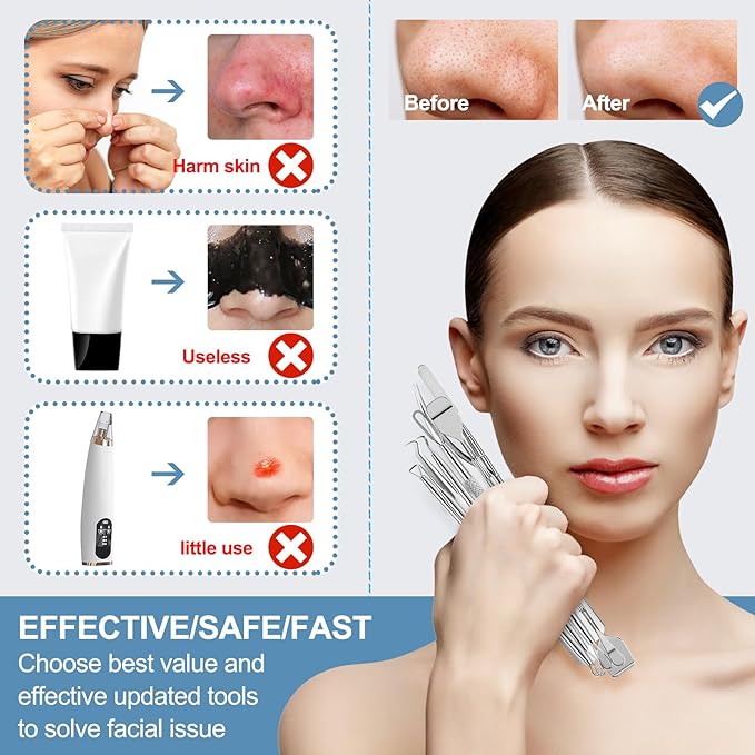 60PCS Dual Heads Blackhead Remover, Pimple Comedone Extractor, Acne Whitehead Blemish Removal Kit, Premium Stainless Steel Pimple Popper Tool kit, Risk Free for Face Skin, with Portable Box