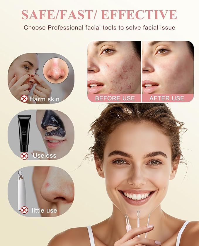 3PCS Pimple Extractor Acne Treatment Tool Professional Stainless Blackhead Comedone Removal Popper Tool for Face Nose Blackhead Extractor Tool (Pink)