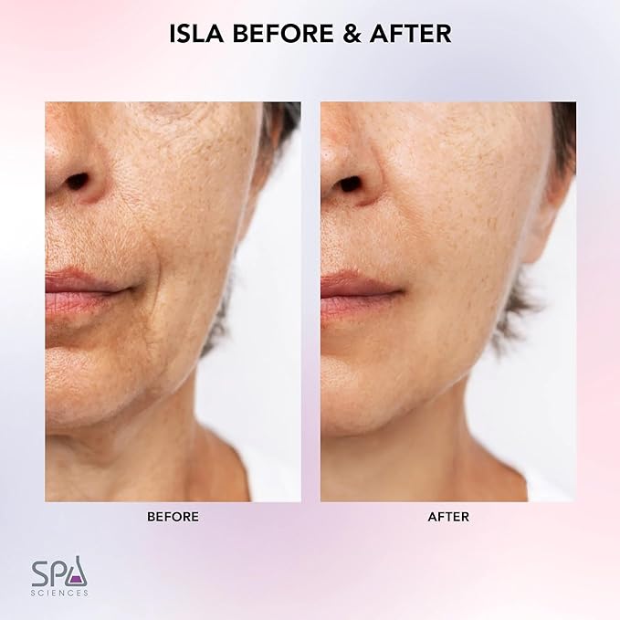 Spa Sciences ISLA Ice + Heat Contouring Roller (Face, Neck, and Décolletage) – Including Steel + Bonus Genuine Rose Quartz Globes