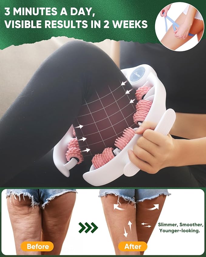 ONUEMP Cellulite Massager Roller, Cellulite Remover Muscle Roller, Fascia Massage Tool for Thigh, Leg, Waist - Anti-Celulitis, Lymphatic Drainage, Body Sculpting, Deep Tissue Pain Relief
