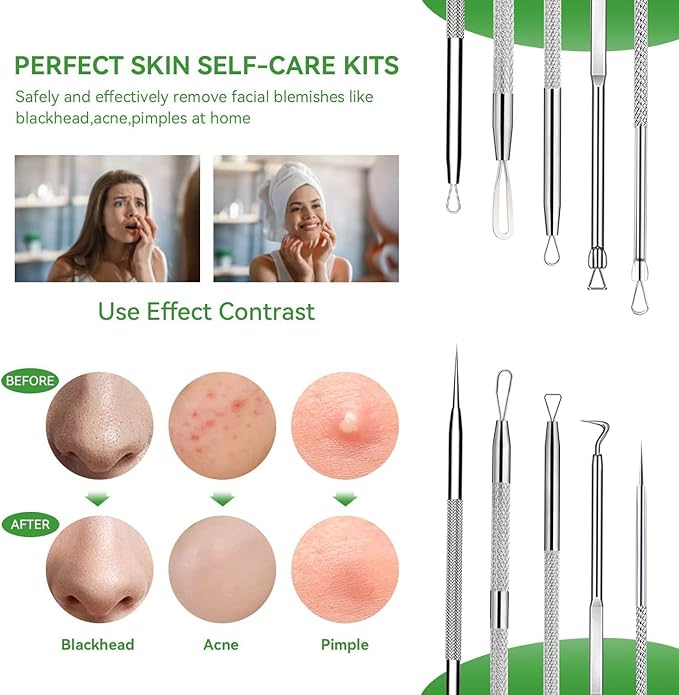 Pimple Popper Tool Kit,Blackhead Remover Tool 5 Pcs Blackhead Extractor Tool for Face Comedone Zit Acne Whitehead Blemish, Stainless Steel Extraction Tools Set