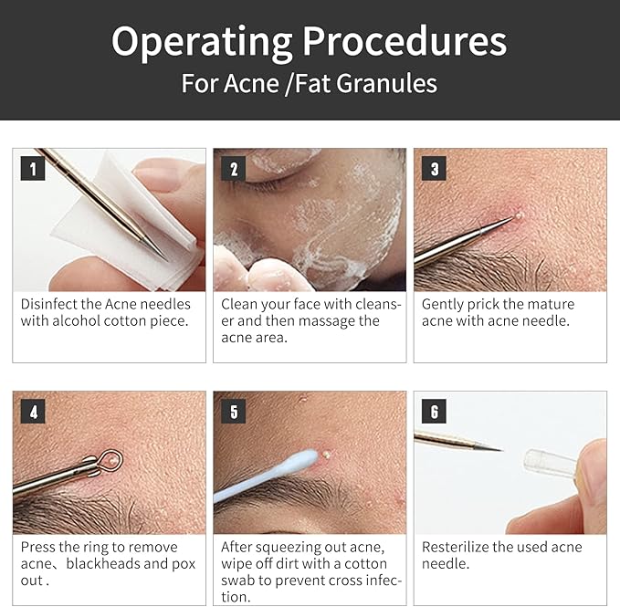 Blackhead Remover Tools,Upgrade 8 PCS Acne Needles,GERY Whitehead Removal Extractor Pimple Popper Kit, Professional Stainless Pimple Blemish and Pore Cleaner Set with Leather Package