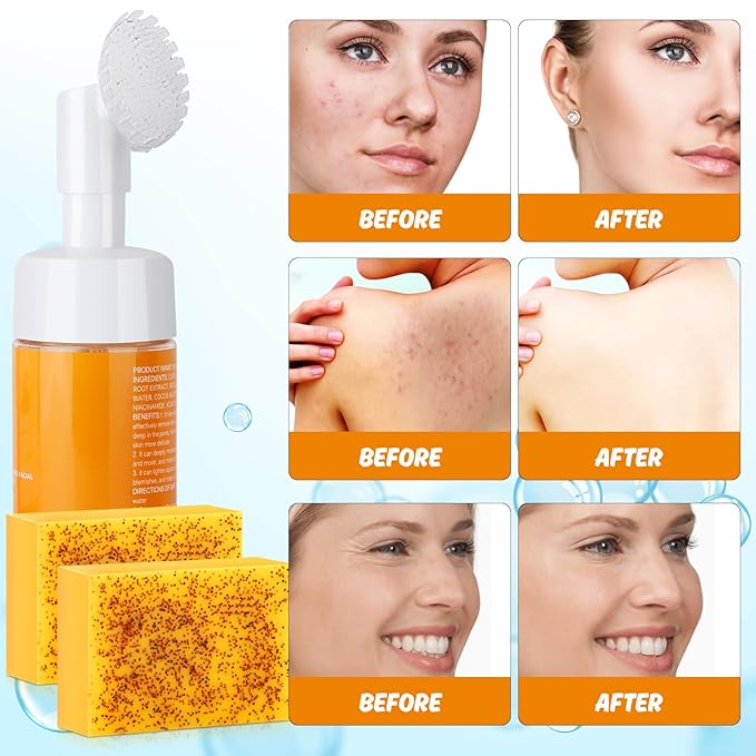 Kojic Acid Soap Set, Lemon Turmeric Kojic Acid Soap Bar & Tuemeric Facial Cleansing Mousse, Deep Cleansing for All Skin Types