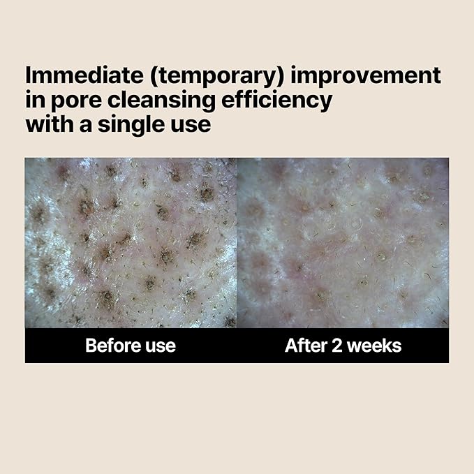 SOME BY MI Lacto Soy Enzyme Deep Cleanser – 3.4oz, 100ml – Korean Vegan Face Wash with Papain & Soy Enzymes for Pore & Dead Skin Care – With Hyaluronic Acid for Soothing & Hydration – Korean Skin Care