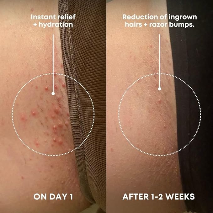 Bushbalm Ingrown Hair Exfoliating Scrub – Pre-Shave Sugar Scrub for Ingrown Hairs, Razor Bumps & Dry Skin – Gently Buffs & Soothes Sensitive Skin – Nude, 236ml