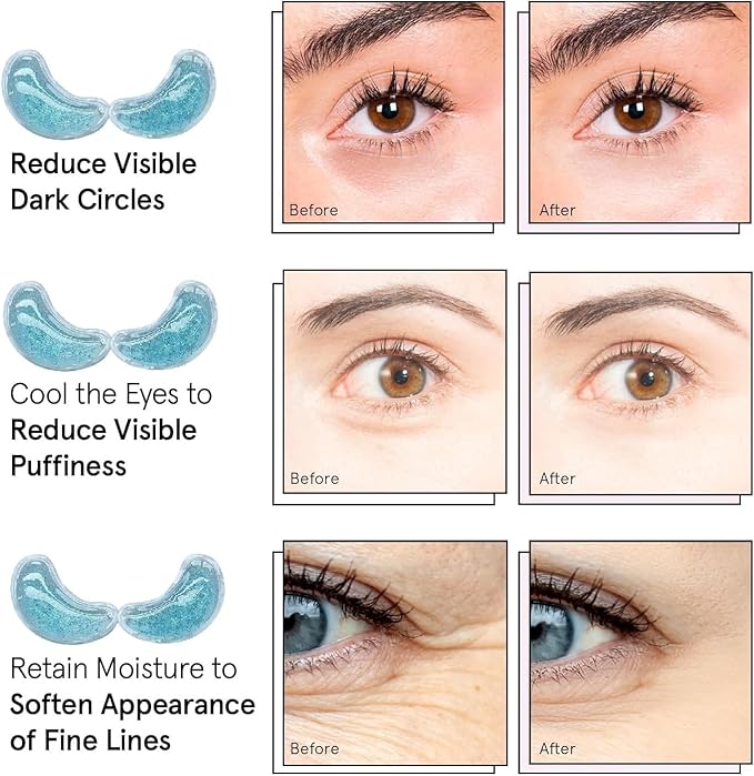 Reusable Under Eye Patches - 8PCS Hot & Cold Gel Eye Pads/Ice Pack for Puffy Eyes, Dark Circles & Eye Bags | Cooling Sleep Mask & Soothing Compress