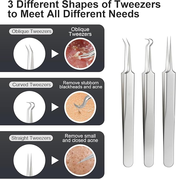 8 Pcs Titanium Alloy Pimple Popper Tool Kit, Pimple Extractor Comedone Extractor Tool, Blackhead Extractor Acne Tools for Face Blemish Whitehead Removal with 20 Alcohol Pads & 10x Magnifying Glass