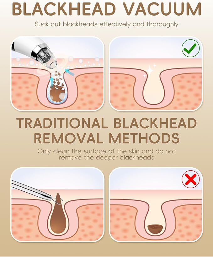Rechargeable Blackhead Vacuum Pore Cleaner - 5 Attachments & 3 Suction Levels for Deep Facial Cleansing, USB-Powered Blackhead Remover for Women and Men (White)