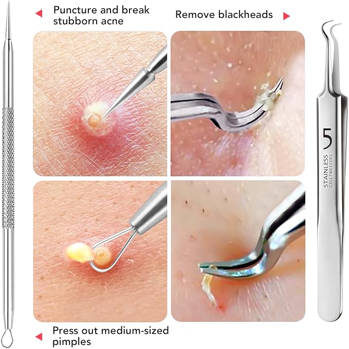Litbear 6 Pcs Blackhead Remover Tools,Pimple Popper Tool Kit,Blackhead Pimple Comedones Extractor,Acne Tools Extractor kit, Scraper for Face Nose Deep Cleansing with Leather Case