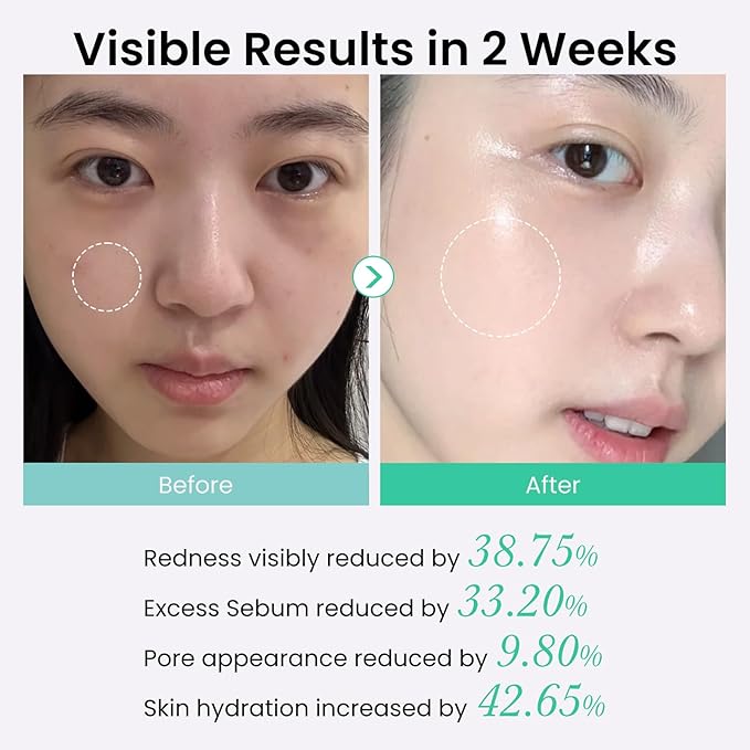 Novaluxe Face Cleansing Pads for Face Wash, Foaming Exfoliating Pads with BHA & Heartleaf, Deep Pore Cleansing & Oil Control, Rinse-Off Facial Pads Alternative to Toner Pads, 70 Count