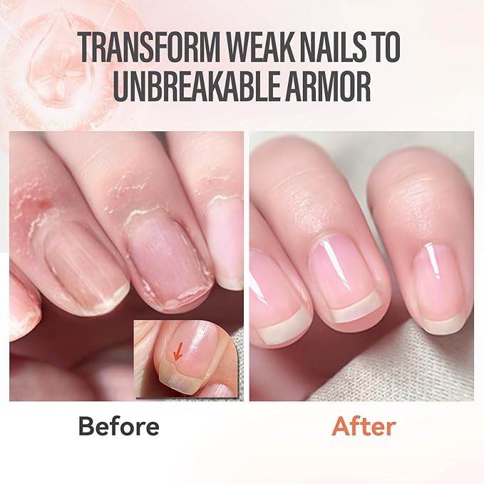 CHUCHU Nail Growth and Strengthener Oil for Cuticle - Peach Scent Cuticle Oil Repair Moisturizing Treatment - Natural Jojoba Vitamin B & E Nail Oil for Dry Cracked Nails