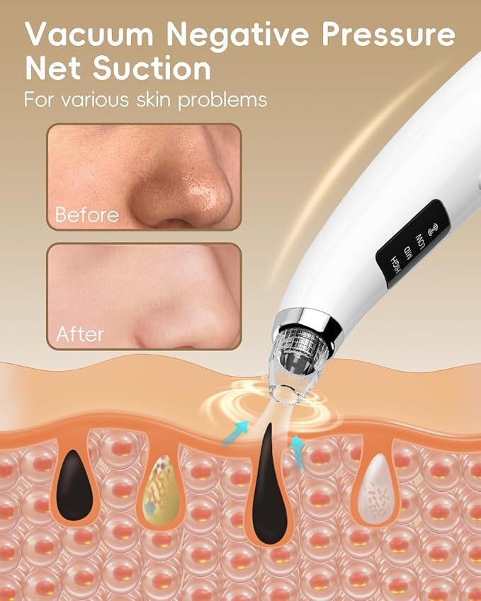 Rechargeable Blackhead Vacuum Pore Cleaner - 5 Attachments & 3 Suction Levels for Deep Facial Cleansing, USB-Powered Blackhead Remover for Women and Men (White)