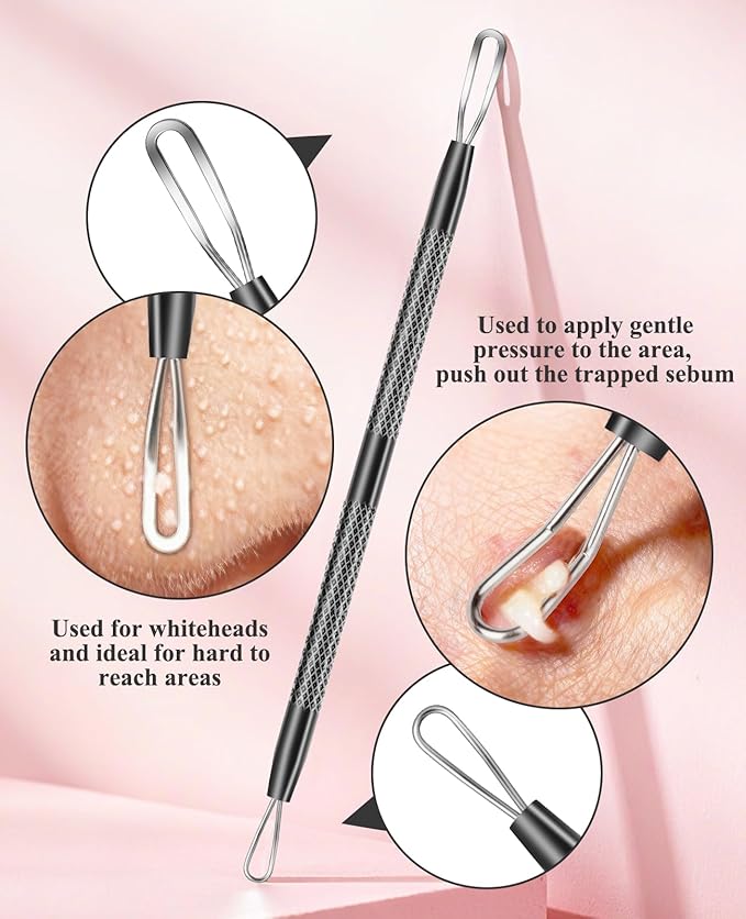 3PCS Pimple Extractor Acne Treatment Tool Professional Stainless Blackhead Comedone Removal Popper Tool for Face Nose Blackhead Extractor Tool (Black)