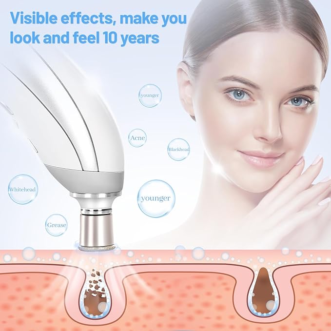 Diamond Professional Microdermabrasion Machine, Portable Dermabrasion Crystal for Facial Skin Care Tool,Face Blackhead Remover Devices Kit,Home Use Microderm Equipment for Women Men