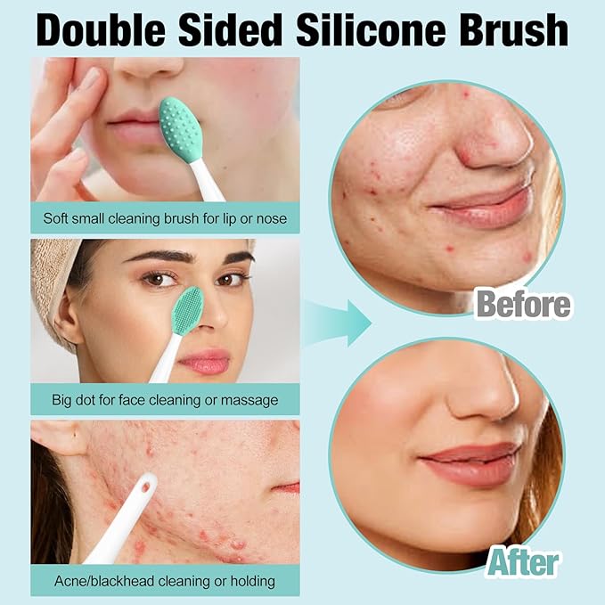 3Pcs Blackhead Remover Pimple Popper Tool Kit Pimple Extractor Acne Treatment Surgical Grade Blackhead Comedone Removal Popper Tool Cleaning Brush for Face Nose Lips