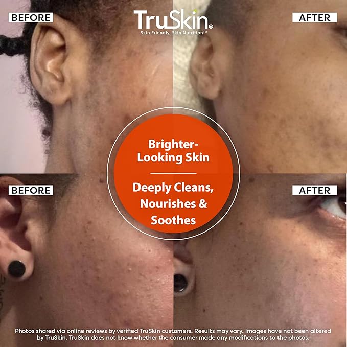 TruSkin Vitamin C Face Wash Cleanser - Brightening Facial Cleanser with Vitamins C & E, Rosehip Oil & Aloe - Gently Cleanses & Refreshes for Radiant-Looking Skin, 5 fl oz