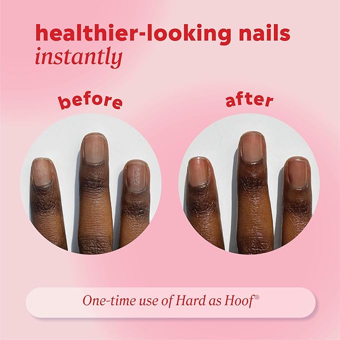 Onyx Professional Hard As Hoof Nail Strengthening Cream, Unscented - Nail Growth & Conditioning Cuticle Cream Stops Splits, Chips, Cracks & Strengthens Nails, 1 oz