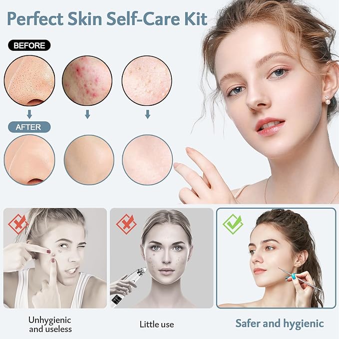 MENOLY Pimple Popper Tool Kit 10 Pcs Blackhead Remover Tool Zit Popper for Blemish, Pimple Comedone Extractor Acne Tool for Blackheads, Acnes, Whiteheads Nose Face with Leather Bag