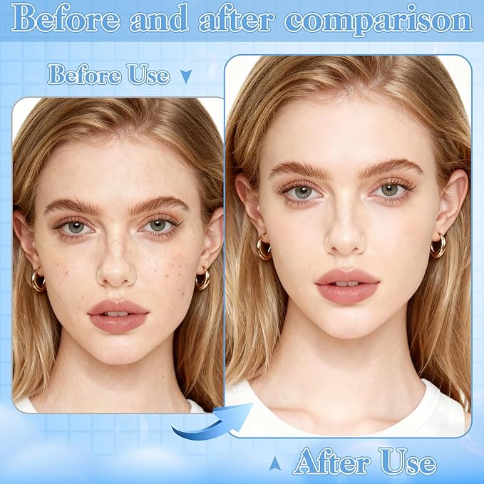 9 PCS Blackhead Extraction Tool Kit, Blackhead Remover Tool Comedones Extractor Acne Removal Kit for Nose Face