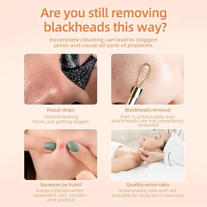1 Pcs Blackhead Remover Tools, Silicone Face Scraper for Deep Cleansing, Nose Blackhead Remover for Women Men - Heart-Shaped - Beige