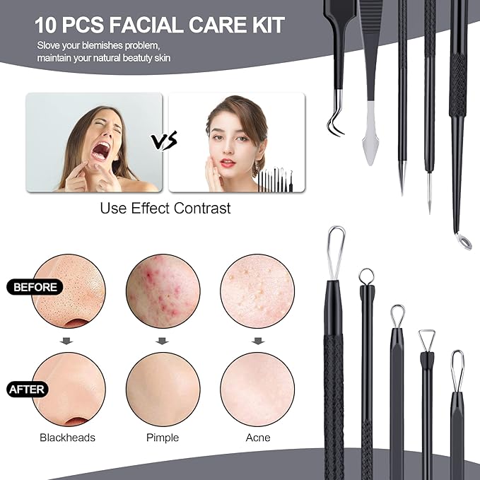 MENOLY Pimple Popper Tool Kit 10 Pcs Blackhead Remover Tool Zit Popper for Blemish, Pimple Comedone Extractor Acne Tool for Blackheads, Acnes, Whiteheads Nose Face Tools with Leather Bag