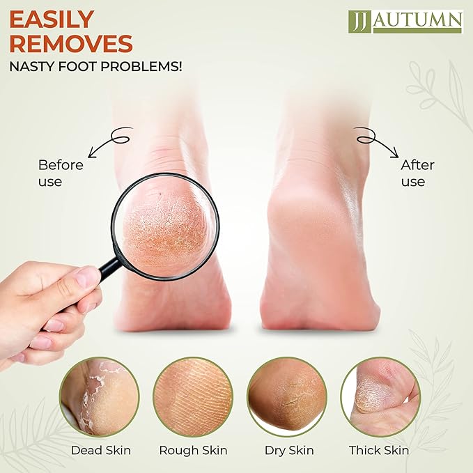 Spa Quality Foot Rasp/Callus Remover Double Sided Wood Professional Foot File Callus Remover for Pedicure and Foot Care - Can Be Used On Both Wet and Dry Feet Achieve Smooth, Silky Feet