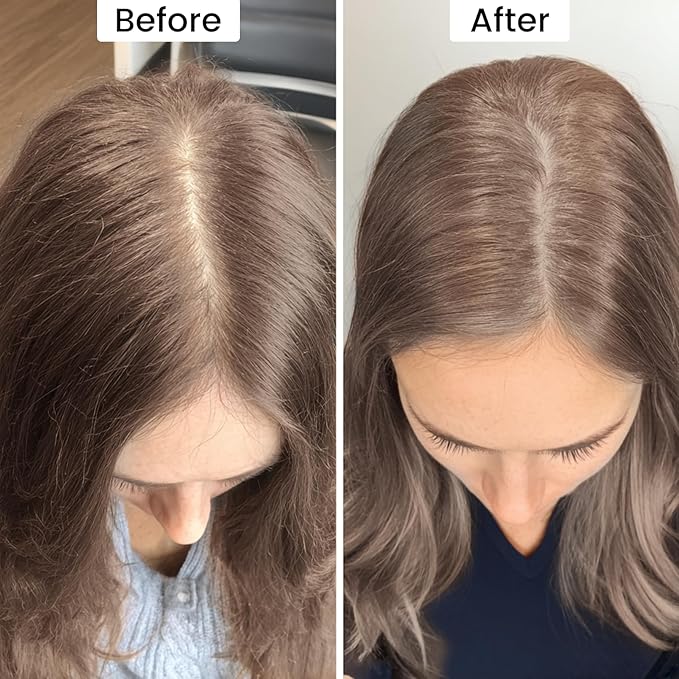 VOLLUCK Root Touch up Powder, Instant Hairline Powder for Thinning Areas and Gray Hair Coverage, Natural and Non-greasy Root Cover up for Women and Men (Light Brown, 0.35 Ounce)