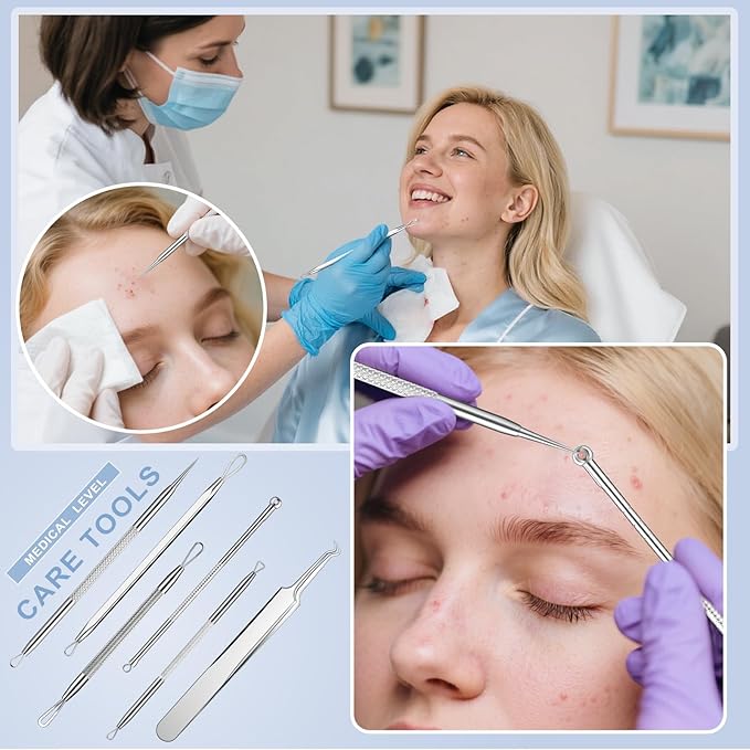 Pimple Extractor Tools, 6-PCS Professional Stainless Steel Blackheads, Whiteheads, Pimples, Boils, Stray Hairs Remover Tools Set with Mirror and Product User Manual, 18-Month Replacement Warranty！