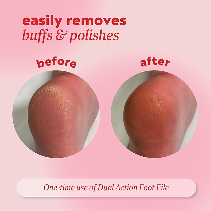 Onyx Professional Double Sided Foot Polisher - Dual Action, Polishing Side, Buffing Side, Stainless Steel, Works on Wet or Dry Feet, Comfortable Grip Handle